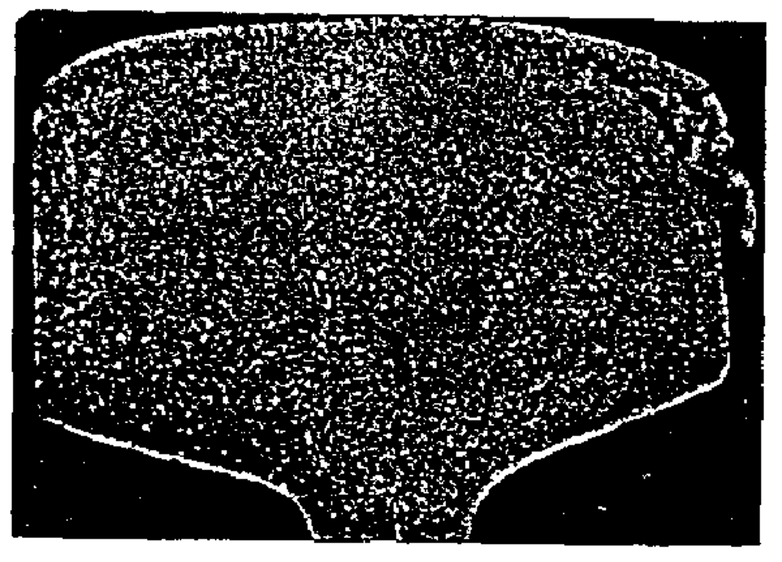 Illustrasjon av avskalling på skinnehode forårsaket av overskridelse av varig dynamisk spenning.