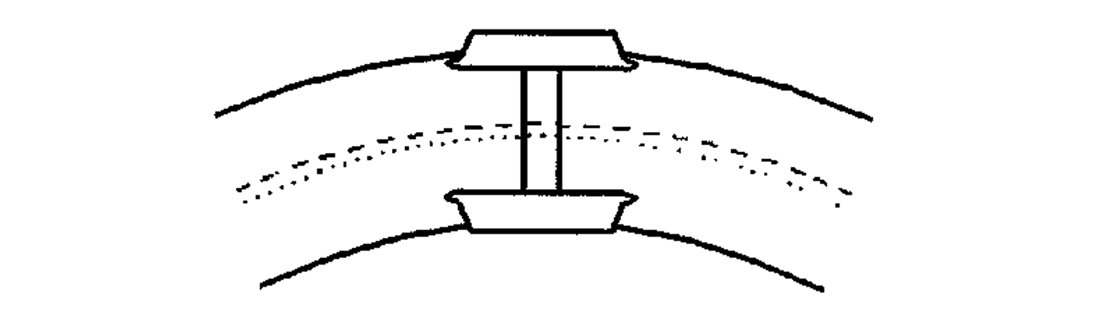 Hjulsett som følger den ideelle linjen i en kurve ved å utligne sporviddeforskjellen.